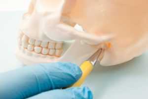 TMJ Pain - Temporomandibular joint / Jaw Pain