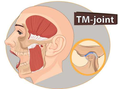 TM Joint TM Joint - TMJ