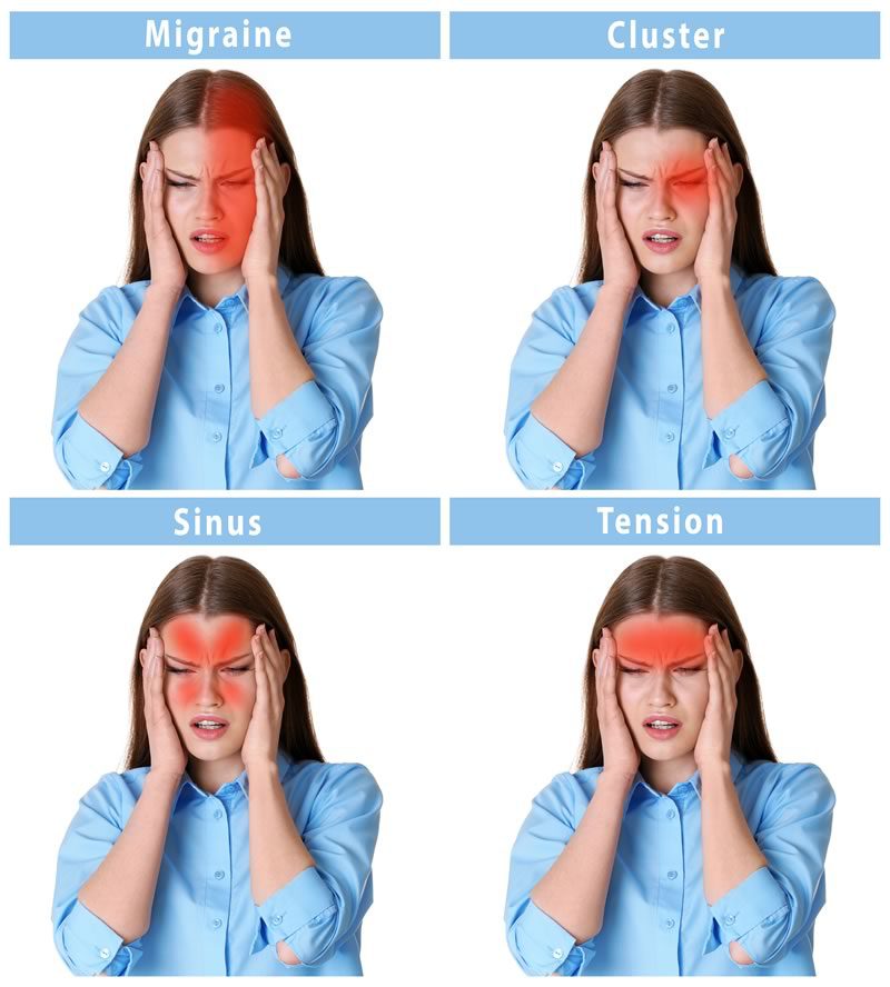 Types of Headaches Types of Headaches